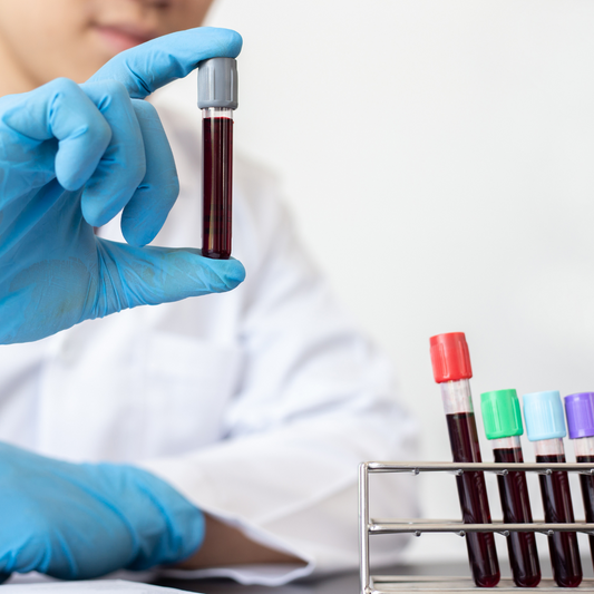 PRUEBA RÁPIDA DE DENGUE (AG NS1, AC IGG E IGM)